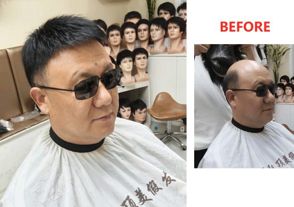 南陽(yáng)男士假發(fā)定制