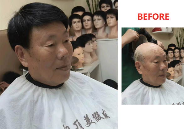 南陽(yáng)男士假發(fā)定制