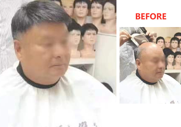 南陽(yáng)男士假發(fā)定制