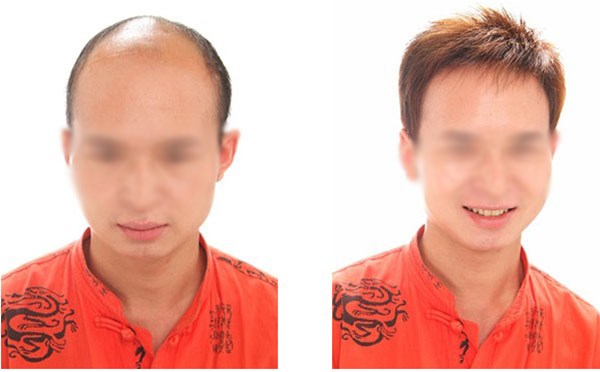 南陽(yáng)假發(fā)卡子，那種比較好？