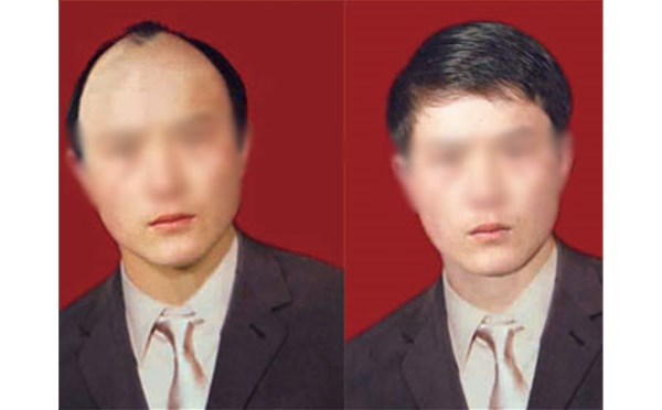 為什么要選擇織發(fā)補發(fā)？