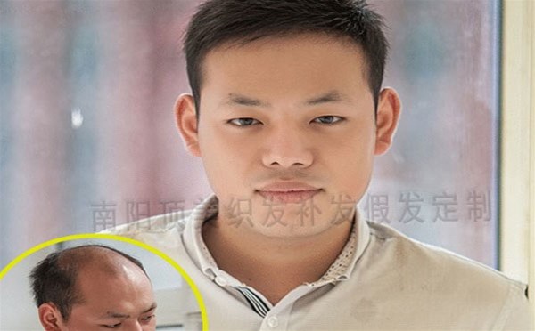 選擇假發(fā)的時(shí)候，一定不能委屈自己 ！