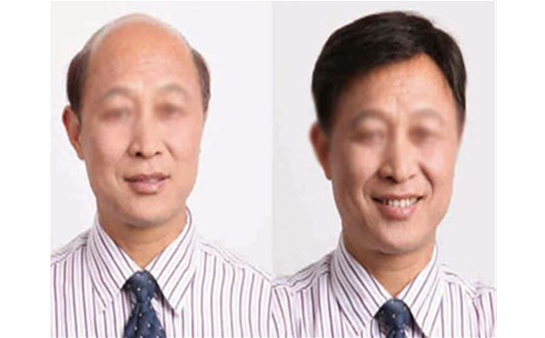 如何正確佩戴南陽(yáng)假發(fā)，南陽(yáng)頂美來(lái)教你！