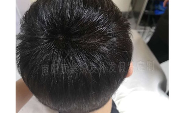 選購假發(fā)的要點(diǎn)有哪些呢？