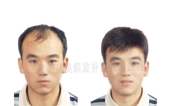 看臉型定做假發(fā)的5大好處！