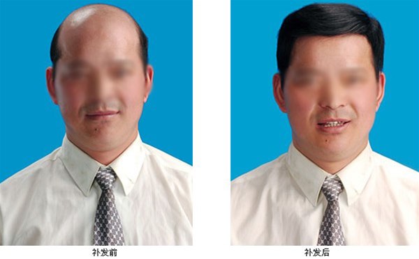 南陽(yáng)織發(fā)，頭發(fā)經(jīng)常出油怎么護理呢？