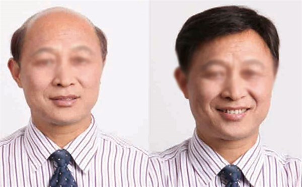 假發(fā)很亂要怎么打理 ？放好位置很重要